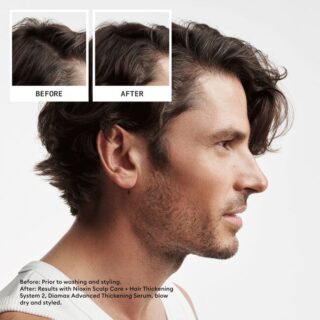 Nioxin System 2, Shampoo, Conditioner, Scalp Treatment - Image 3
