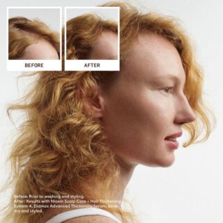 Nioxin System Trial Kit 4, Cleanser, Scalp Therapy, Scalp Treatment - Image 3